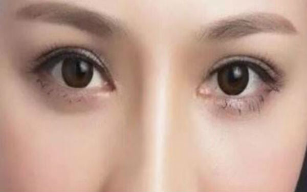 昆明哪家醫(yī)院割雙眼皮技術獨特？僅此三家值得信賴！