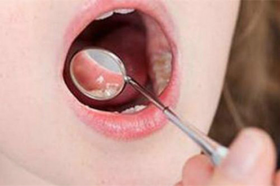 南昌激光祛生長紋醫(yī)生