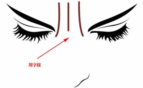 成都雙眼皮修復手術：五家性價比高、技術好的醫(yī)院推薦