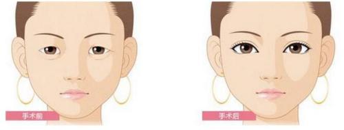 永州祛斑好的醫(yī)院排行榜前六甄選，你值得了解