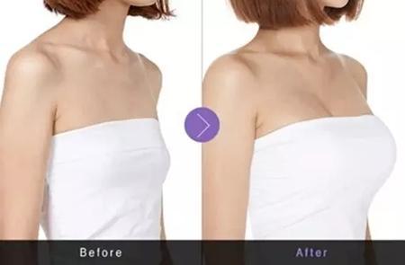 沈陽磨骨瘦臉五大頂級技術(shù)推薦，這幾家技術(shù)最受關(guān)注！