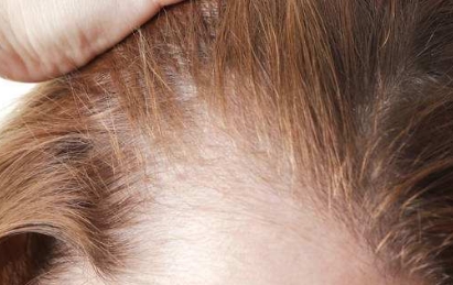 洛陽最受歡迎的雙眼皮整形醫(yī)院排行榜！預(yù)算驚喜！