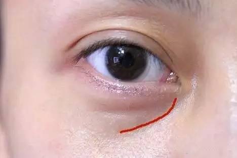 沈陽哪家醫(yī)院做雙眼皮好？推薦這幾家，讓你的雙眼美麗動人起來！