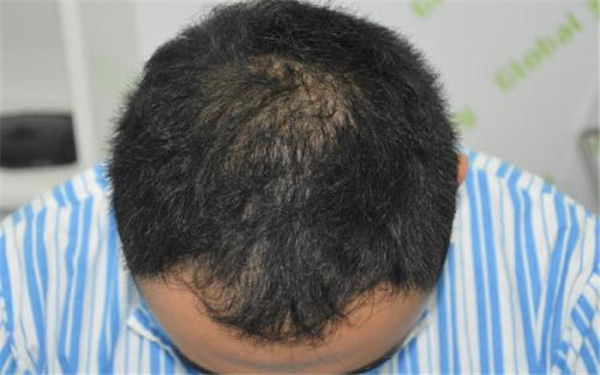 濰坊市三家最受好評(píng)的祛痘整形美容醫(yī)院匯總及詳細(xì)評(píng)分