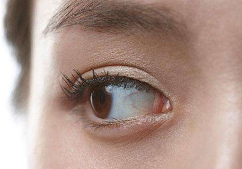 南京光子去眼底紋醫(yī)生