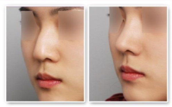 沈陽植發(fā)醫(yī)院排名：雍禾、科發(fā)源、碧蓮盛、華美上榜！