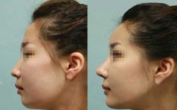 深圳頂級(jí)整容醫(yī)院排行榜發(fā)布！整形美容醫(yī)院報(bào)價(jià)明細(xì)表最新更新