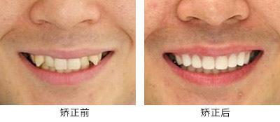 湖南綜合實(shí)力最強(qiáng)的整形醫(yī)院排行榜：這十家業(yè)內(nèi)知名醫(yī)院等你探尋！