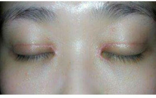 沈陽超贊的私密緊致術醫(yī)院匯總排名前十，曙光、美萊技術對比分析，各有獨特魅力！