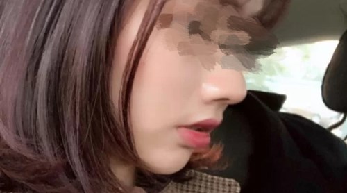 煙臺(tái)雙眼皮整形醫(yī)院排名前五名揭曉！用戶口碑持續(xù)贊賞