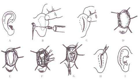 深圳眼部整形業(yè)內(nèi)杰出醫(yī)生盤點！錯過可惜，快來查看！