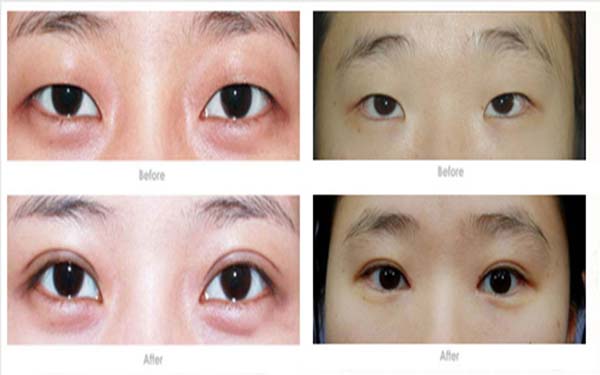 淮安有哪些口碑很好的整形醫(yī)院？前五排名來了！