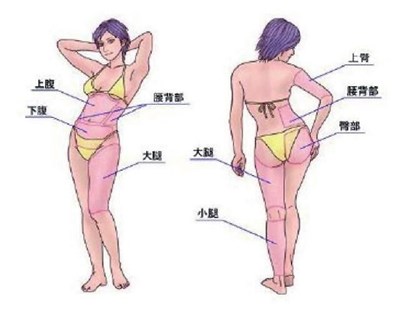 南京消除生長(zhǎng)紋術(shù)醫(yī)生