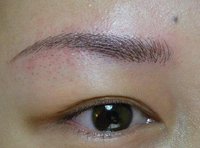 榆林市雙眼皮良心推薦！權(quán)威醫(yī)美機(jī)構(gòu)幫你找對(duì)方法