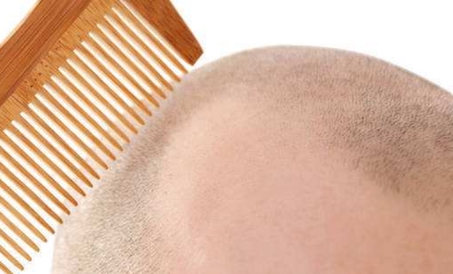 滄州市哪家醫(yī)院的隆鼻整形技術(shù)最實力？排行榜公布！