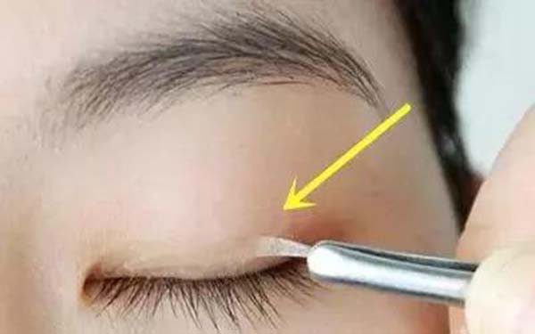 汕頭植發(fā)醫(yī)院排行榜前六：雍禾稱霸！曙光、華美也上榜！快來了解一下吧