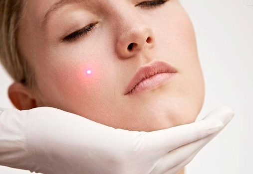 咸陽注射細(xì)紋醫(yī)生