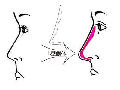 深圳最佳激光脫毛整形醫(yī)院推薦-公立醫(yī)院領跑市場！