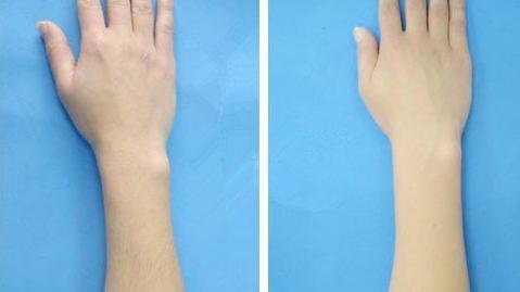 泰安斑點治療醫(yī)院排行榜：選擇這些醫(yī)院，讓斑點不再遮擋你的美麗~