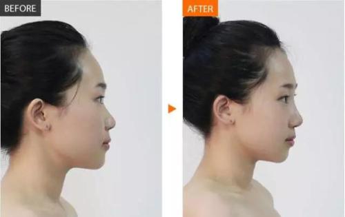 匯總！萬州洗紋身醫(yī)院口碑大幅提升，新六強評選開始！火爆更新中