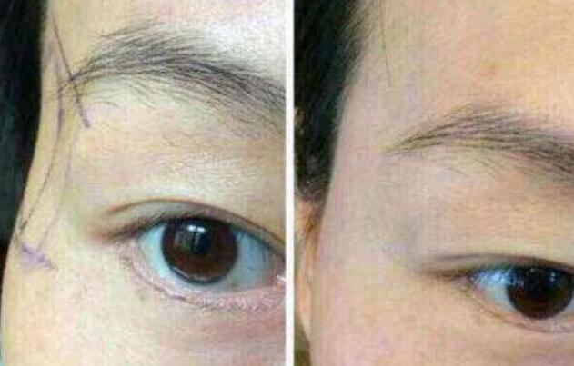 江蘇區(qū)整容醫(yī)院推薦：想在江蘇改頭換面的友人來看看這篇！高質(zhì)量美容機(jī)構(gòu)盤點(diǎn)提供參考