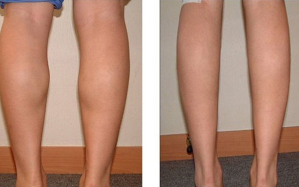 珠海哪里有好的雙眼皮醫(yī)院？推薦幾家備受好評(píng)的醫(yī)院！