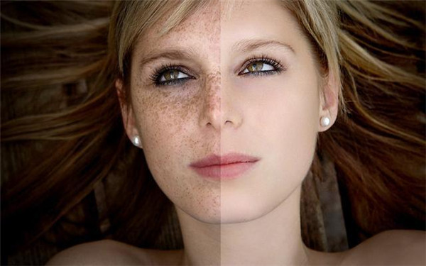 河北雙眼皮調(diào)理醫(yī)生