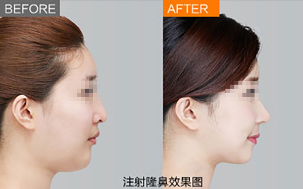 邯鄲美容醫(yī)院好評TOP6，專家推薦綜合評價！