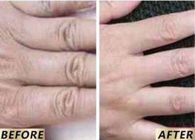 西安哪家整形醫(yī)院綜合實(shí)力強(qiáng)，口碑好！米蘭柏羽榜首完勝！