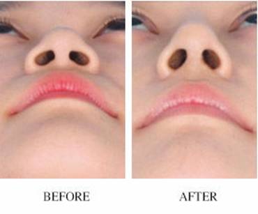 甘肅面部輪廓固定抗衰醫(yī)生