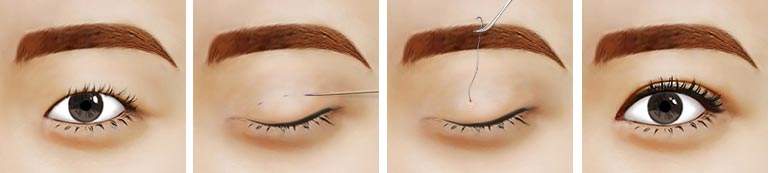 西安抽脂大咖薈萃：受歡迎醫(yī)生，眾多愛美者青睞！