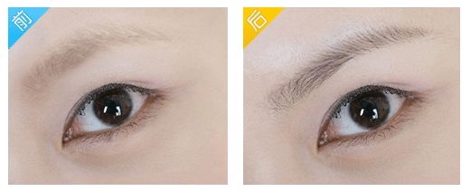 福州顏值煥新，無色斑醫(yī)療機(jī)構(gòu)比拼，揭示誰更勝一籌