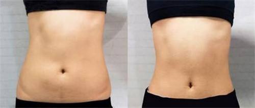 福州隆鼻整形醫(yī)生推薦匯總：專家升級，暢談口碑與擅長！