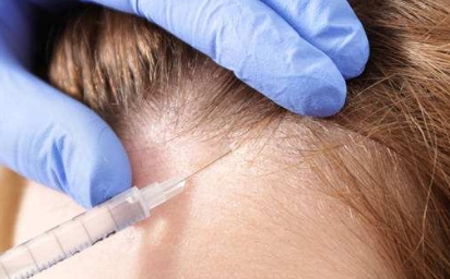 祛斑醫(yī)院推薦：打破斑點煩惱，找回美麗肌膚