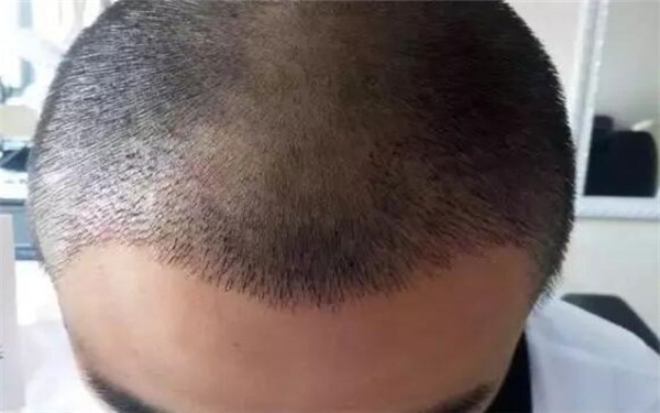 精選西安鼻子整形醫(yī)院榜單揭曉！美容專(zhuān)家推薦匯總單供您參考