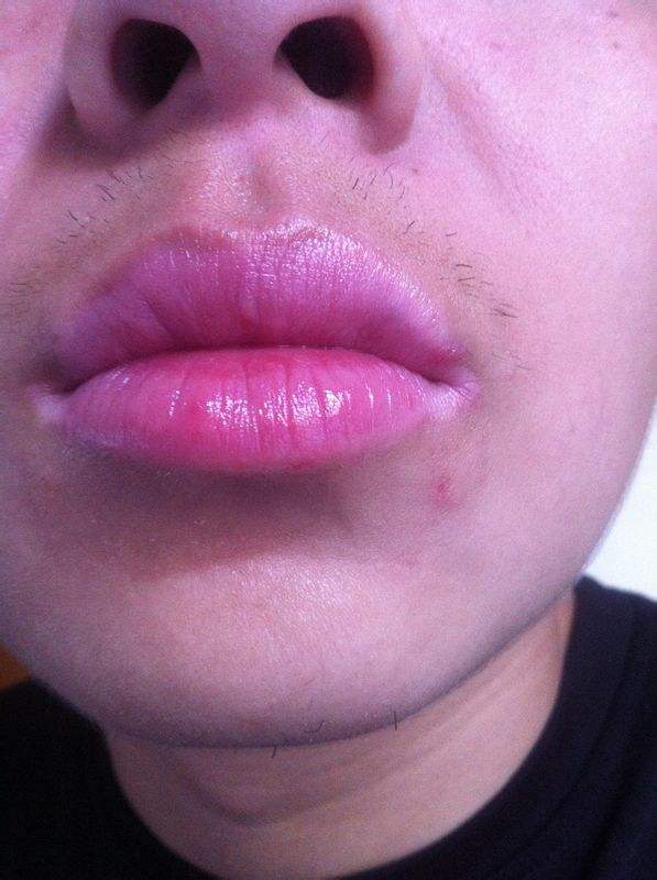 鞍山極速動感無痕豐胸術(shù)醫(yī)生