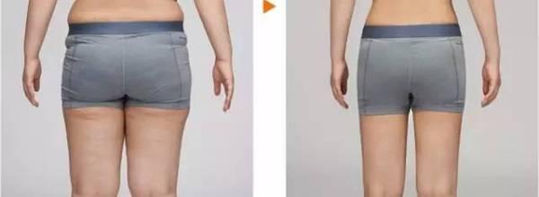 珠海頂級(jí)整容醫(yī)院推薦！價(jià)目表揭秘！