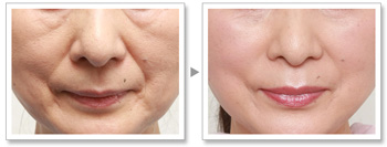 菏澤地區(qū)綜合比較排名前十的牙齒矯正醫(yī)院