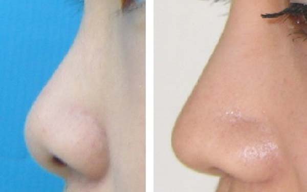 綿陽市哪家醫(yī)院祛斑技術(shù)靠譜？推薦8家口碑不錯的實力派！