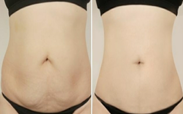 盤點溫州十佳隆鼻醫(yī)生，暢談鼻部整形專家與收費標準！