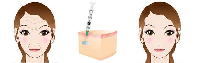 煙臺(tái)治療腋臭醫(yī)院評(píng)選出的五家佼佼者！優(yōu)秀的曙光、青韓、壹美天成值得推薦！