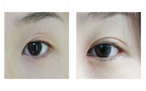 熱瑪吉整形醫(yī)院最受好評的六個機構(gòu)合集！尋找這些隱藏的寶藏醫(yī)院，分享給你，讓你重拾自信！