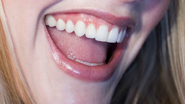 云南去雙下巴手術(shù)醫(yī)生