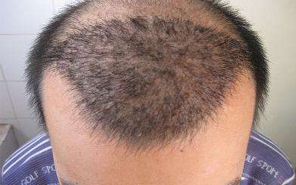 長春三家牙齒整形醫(yī)院推薦：白求恩、段氏、華植等音譽(yù)卓著