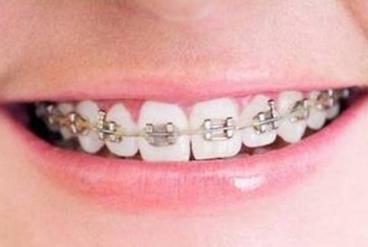 重慶激光洗紋身整形醫(yī)院聚焦盛夏排行榜，單品強(qiáng)力推薦！