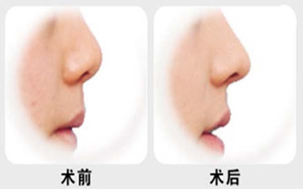 陜西地區(qū)頂級整形醫(yī)院排名揭曉！信賴度高，公立和私立可靠權威推薦！