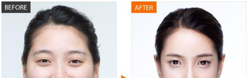 重慶最佳口腔專科醫(yī)院排名公布！附牙齒矯正快速詢價攻略