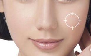 南昌法令紋祛除手術(shù)醫(yī)生