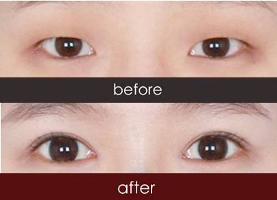 西安做達拉斯隆鼻醫(yī)生