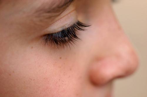 鄭州溶脂去眼底紋醫(yī)生